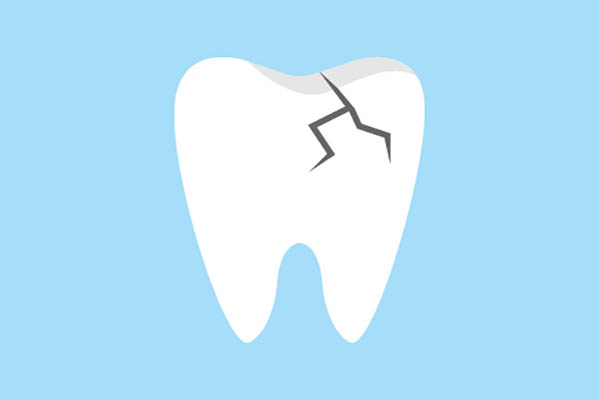 Ask An Implant Dentist About Replacing A Damaged Tooth