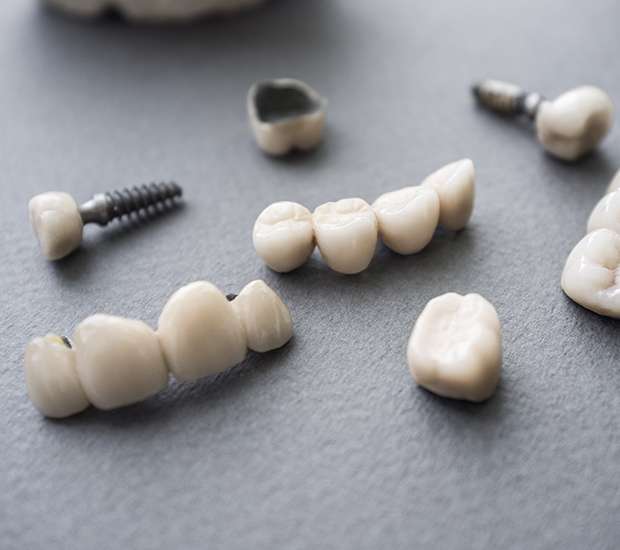 Fort Lauderdale The Difference Between Dental Implants and Mini Dental Implants