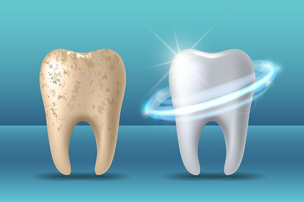 Pros and Cons of Teeth Whitening Treatments from Smiles By Julia in Fort Lauderdale, FL