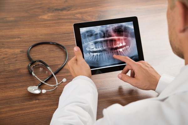 Why Dental X Rays Are Important In The Root Canal Procedure