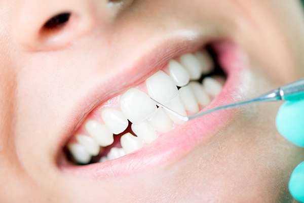Types of Teeth Cleaning: Quadrant versus Standard - Smiles By Julia Fort Lauderdale Florida