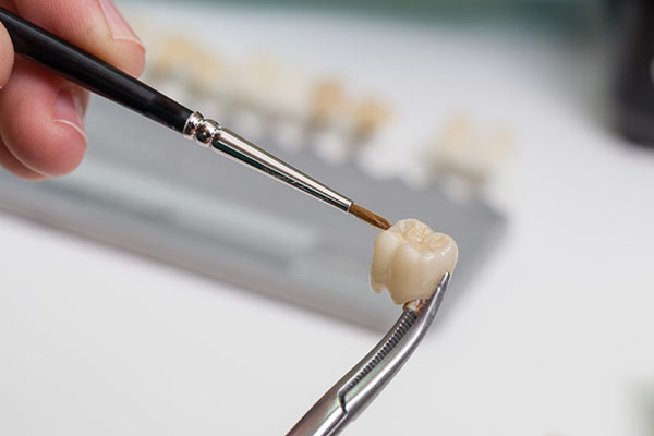What You Should Know About the CEREC Crown Procedure from Smiles By Julia in Fort Lauderdale, FL